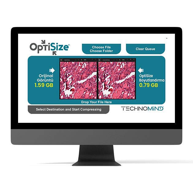 OptiSize